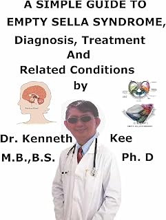 A Simple Guide To Empty Sella Syndrome, Diagnosis, Treatment And Related Conditions