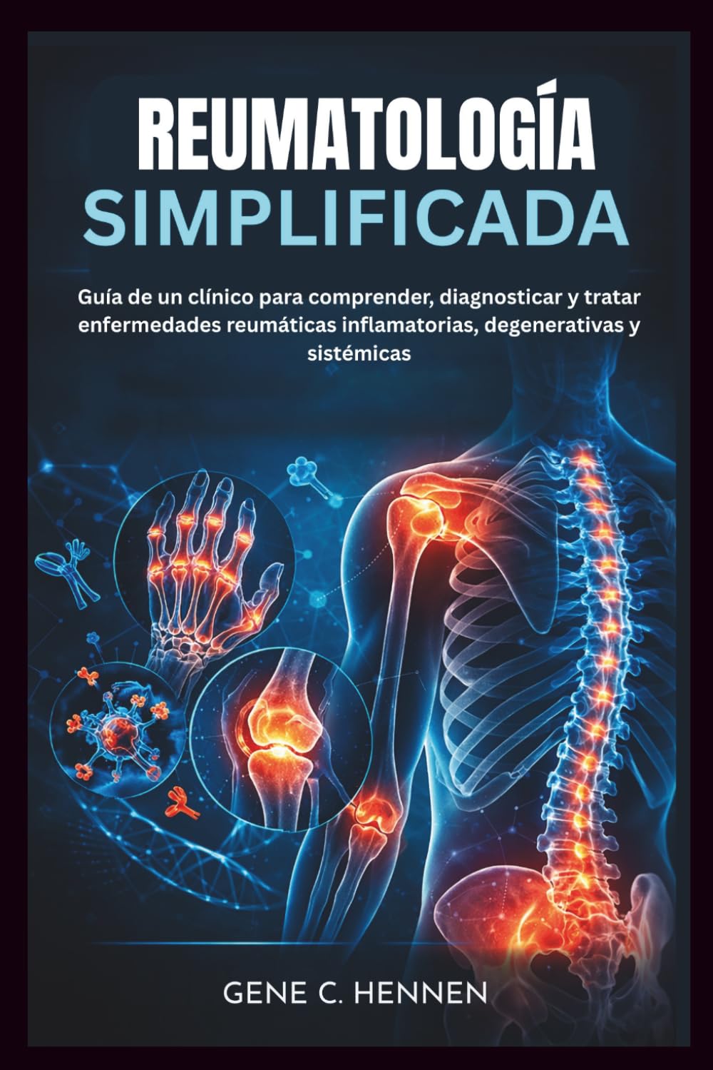 REUMATOLOGÍA SIMPLIFICADA: Guía de un clínico para comprender, diagnosticar y tratar enfermedades reumáticas inflamatorias, degenerativas y sistémicas