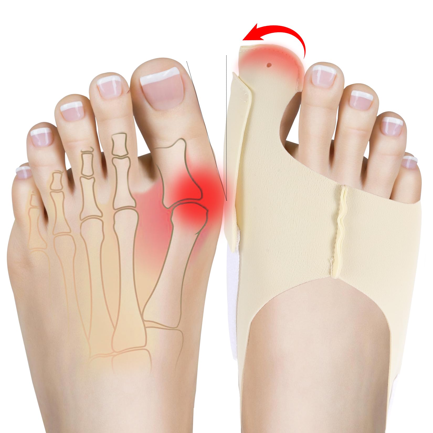 NOWFRESH Bunion Corrector for Women & Men - Adjustable Toe Straightener with Customizable Support, Day & Night Wear, Comfortable Toe Separators for Bunion Relief, Thumb Valgus Correction(XL)