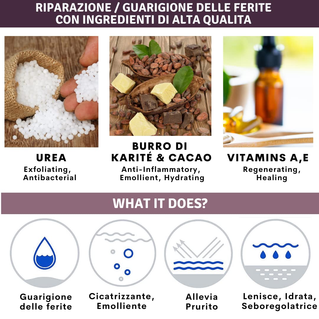 Crema Urea 30%, 100ml, Eczemi, Cheratosi, Psoriasi, Eruzioni Cutanee, Dermatite, Prurito, Piedi Secchi, Talloni Screpolati, Calli, Duroni | Idratazione Profonda | Vitamin A, E, Burro di karitè