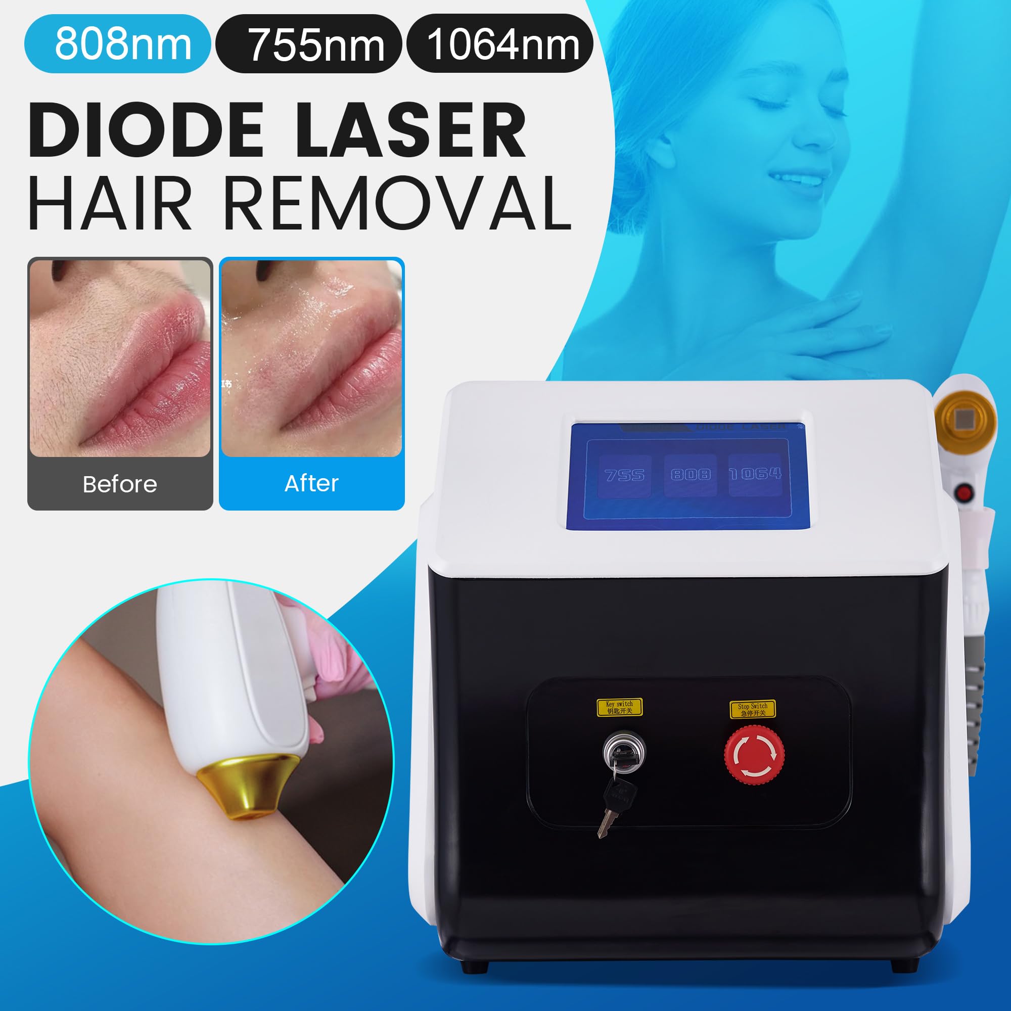 Epilazione Permanente Laser Diodo 808nm per Corpo Viso e Gambe