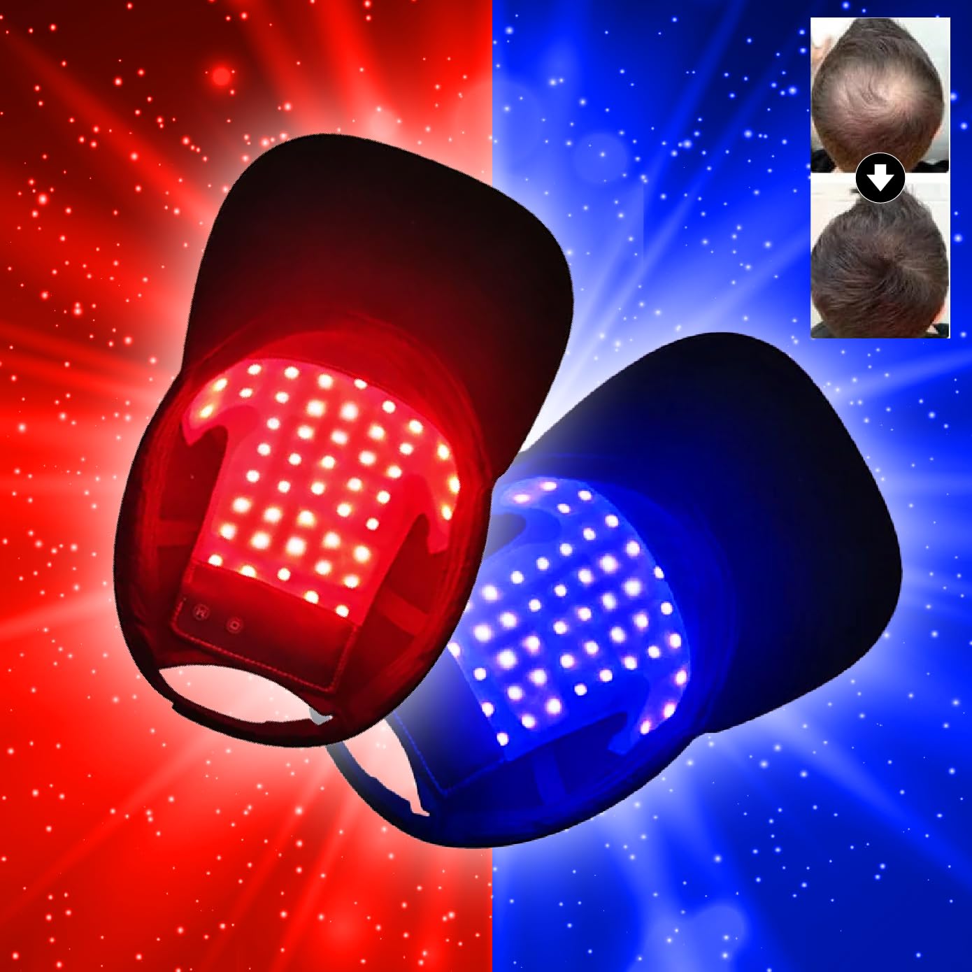 Amazon.co.jp: 赤色LED 青色LED 48LED 育毛キャップ 増毛 スカルプケア 