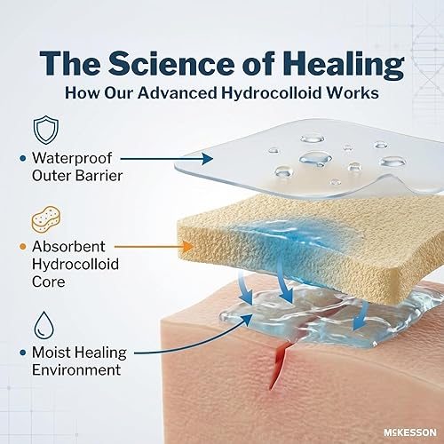 Miniatura 4 de McKesson 1886 Apósito hidrocoloide, respaldo de película, estéril, 2 pulgadas de ancho, 2 pulgadas de largo (paquete de 20)
