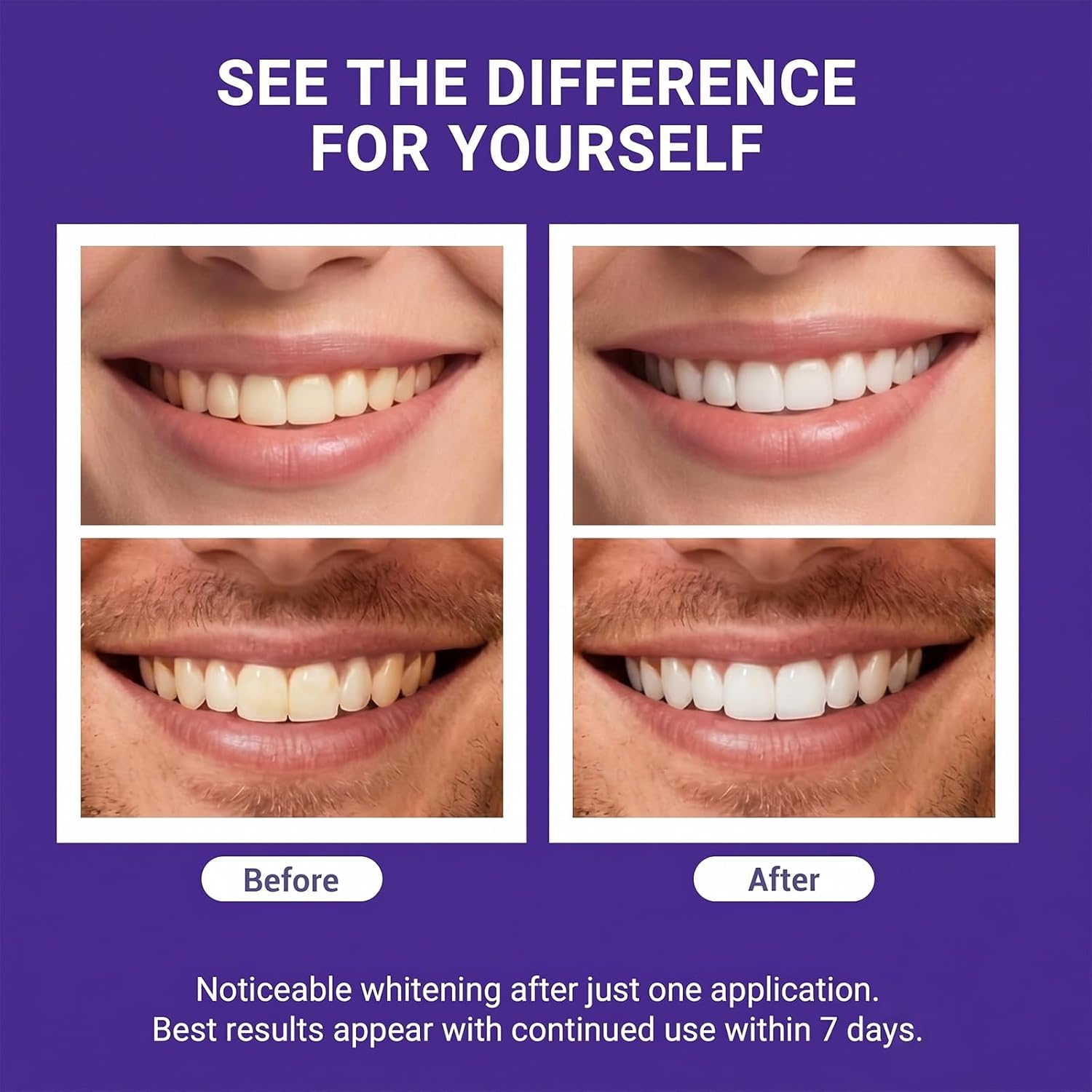 Advanced Purple Teeth Whitening Strips, 28-Day Premium Color Correcting Treatment, Peroxide-Free & Enamel-Safe Tooth Whitener for Sensitive Teeth, Luxury At-Home Smile Care(2 Boxes)