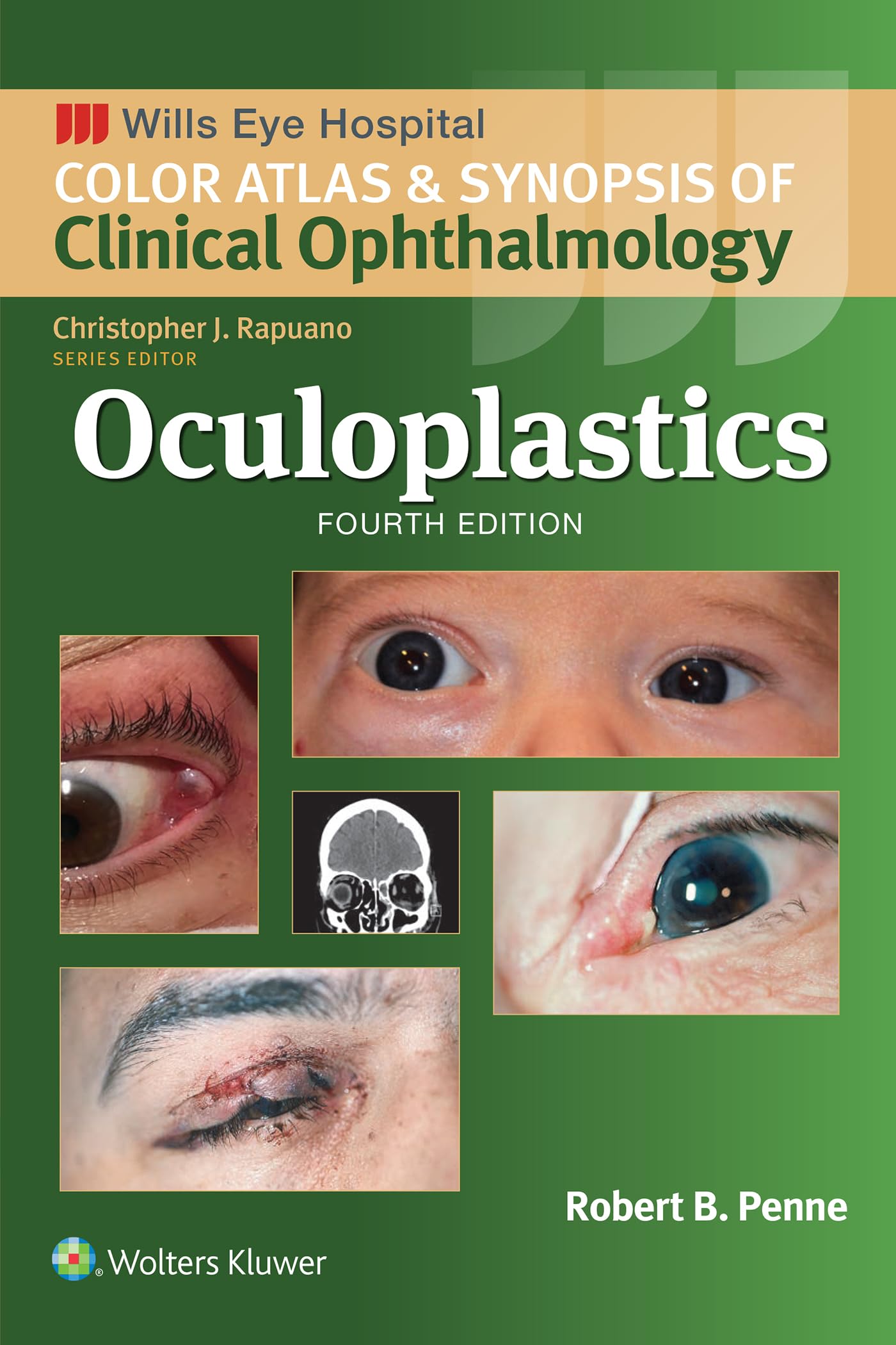 Oculoplastics (Wills Eye Institute Atlas Series) (English Edition)