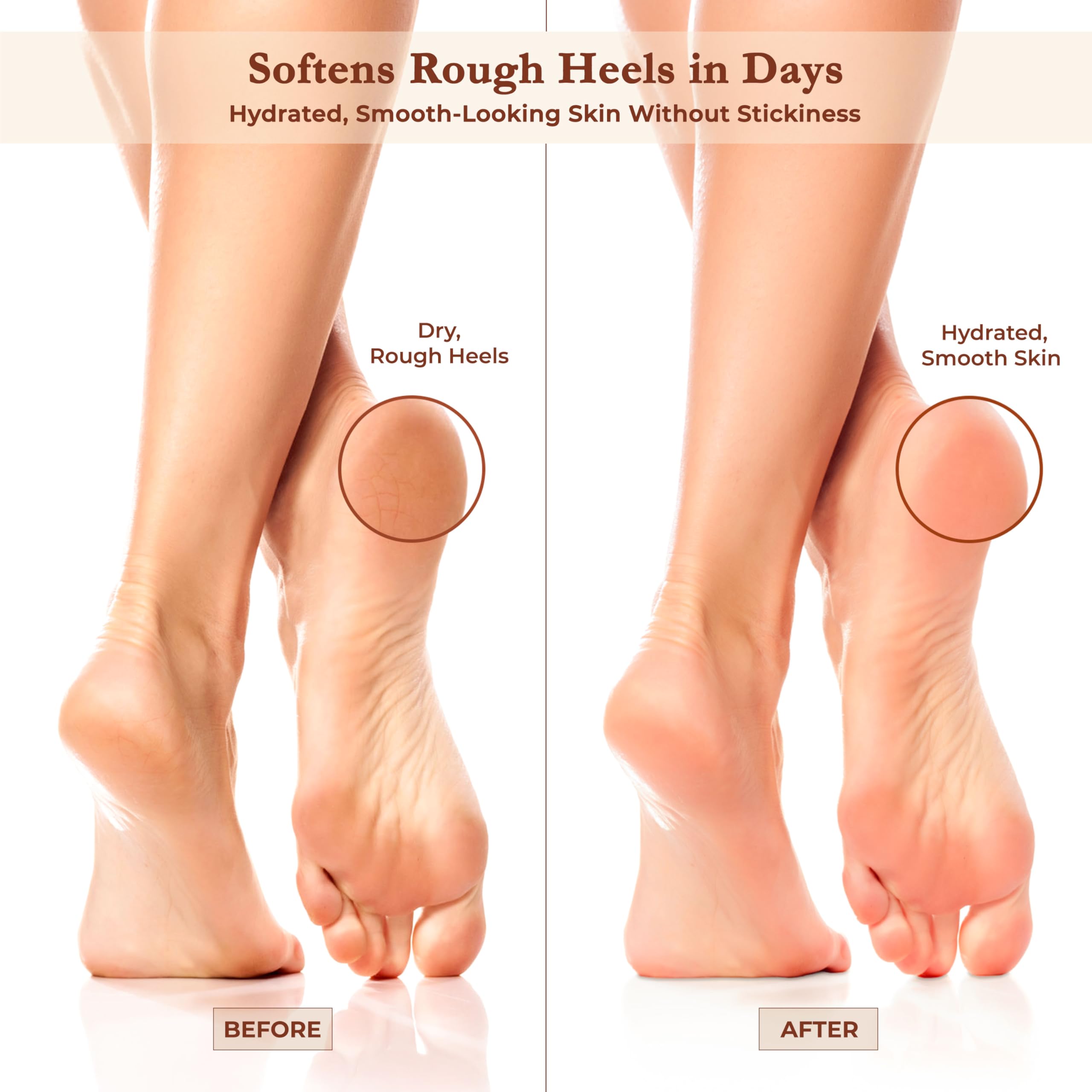 Foot Cream for Dry Cracked Heels and Feet Moisturizer with Argan Oil, Shea Butter & Vitamin E – Hydrating Foot Lotion for Dry Cracked Feet for Women – Smooth, Fast-Absorbing, Non-Sticky Care