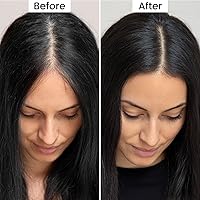 Vista 5 de VOLLUCK Polvo de retoque de raíz, polvo instantáneo para la línea del cabello para áreas delgadas y cobertura de cabello gris, cobertura de raíz