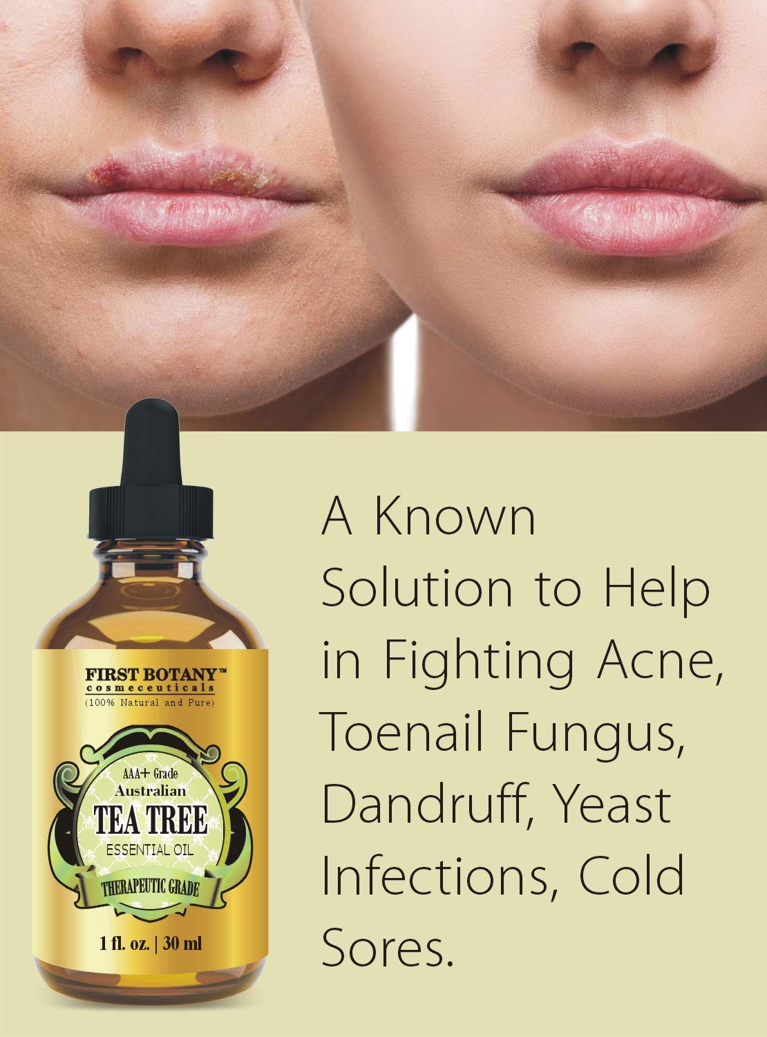 100 Pure Australian Tea Tree Essential Oil with high conc. of Terpinen