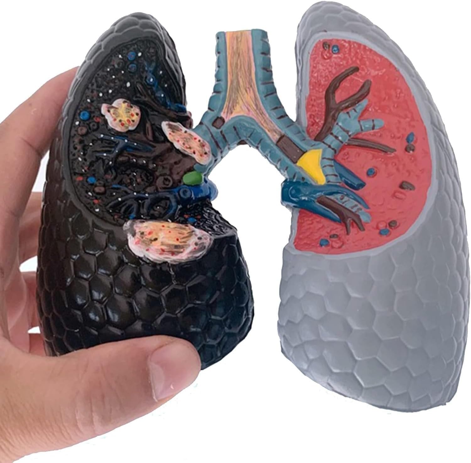 Model porównawczy palenia i zdrowych płuc, model anatomiczny dróg oddechowych i oskrzeli do nauczania, narzędzie do wyświetlania nauczania medycznego