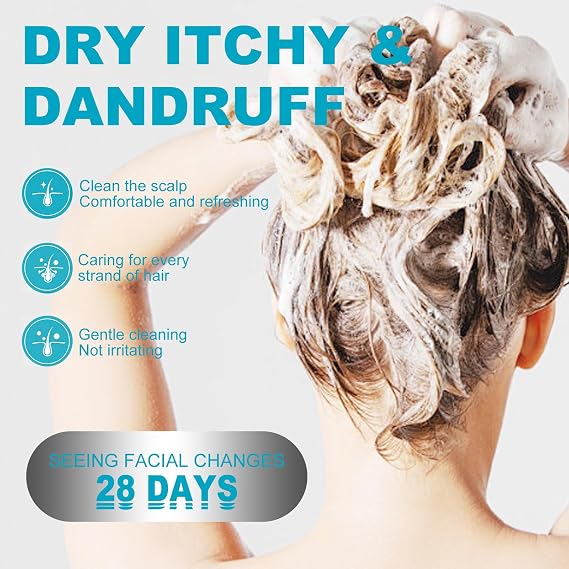 Psoriasis Shampoo, Seborrheic Dermatitis Sham-poo, Herbal EssenceShampoo, Coal Tar Dandruff Shampoo, Dry Scalp shampoo, Folliculitis Shampoo, Dandruff Treatment,Hydrate Hair,Relieve from Itchy (2PCS)