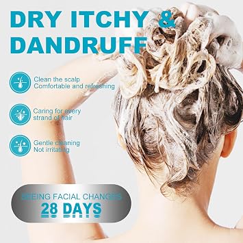 Psoriasis Shampoo, Seborrheic Dermatitis Sham-poo, Herbal EssenceShampoo, Coal Tar Dandruff Shampoo, Dry Scalp shampoo, Folliculitis Shampoo, Dandruff Treatment,Hydrate Hair,Relieve from Itchy (2PCS)