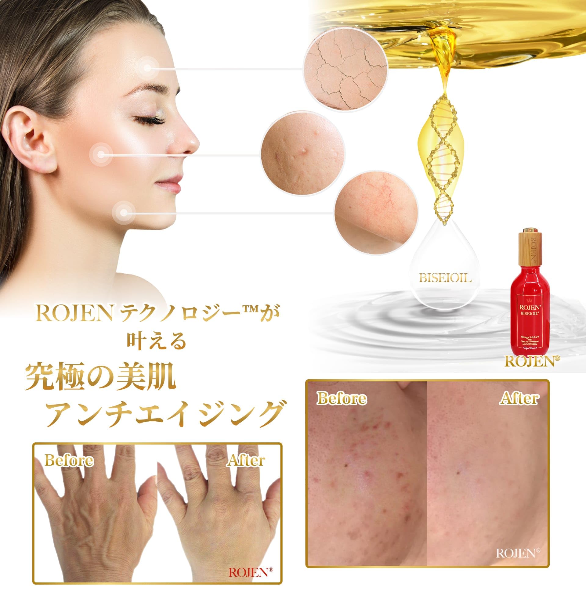 Amazon.co.jp: ROJEN ダマスクローズ美整オイル 60ml (顔 髪 全身 