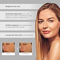 Vista 5 de Glytone Complejo iluminador mejorado: con 12% de ácido azelaico, 3% ácido glicólico, ilumina la piel y reduce las manchas oscuras, no comedogénico