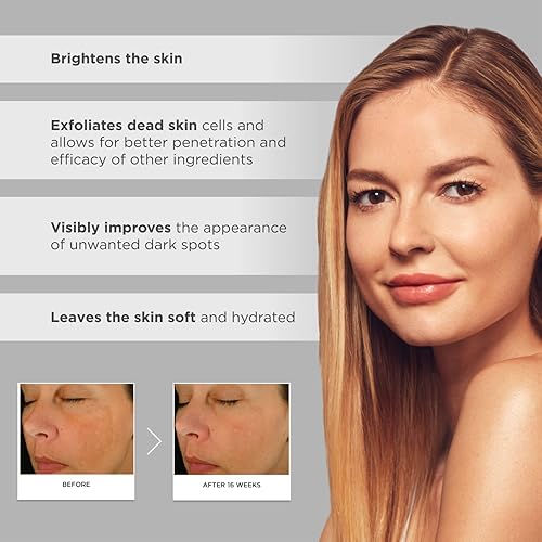 Miniatura 5 de Glytone Complejo iluminador mejorado: con 12% de ácido azelaico, 3% ácido glicólico, ilumina la piel y reduce las manchas oscuras, no comedogénico,