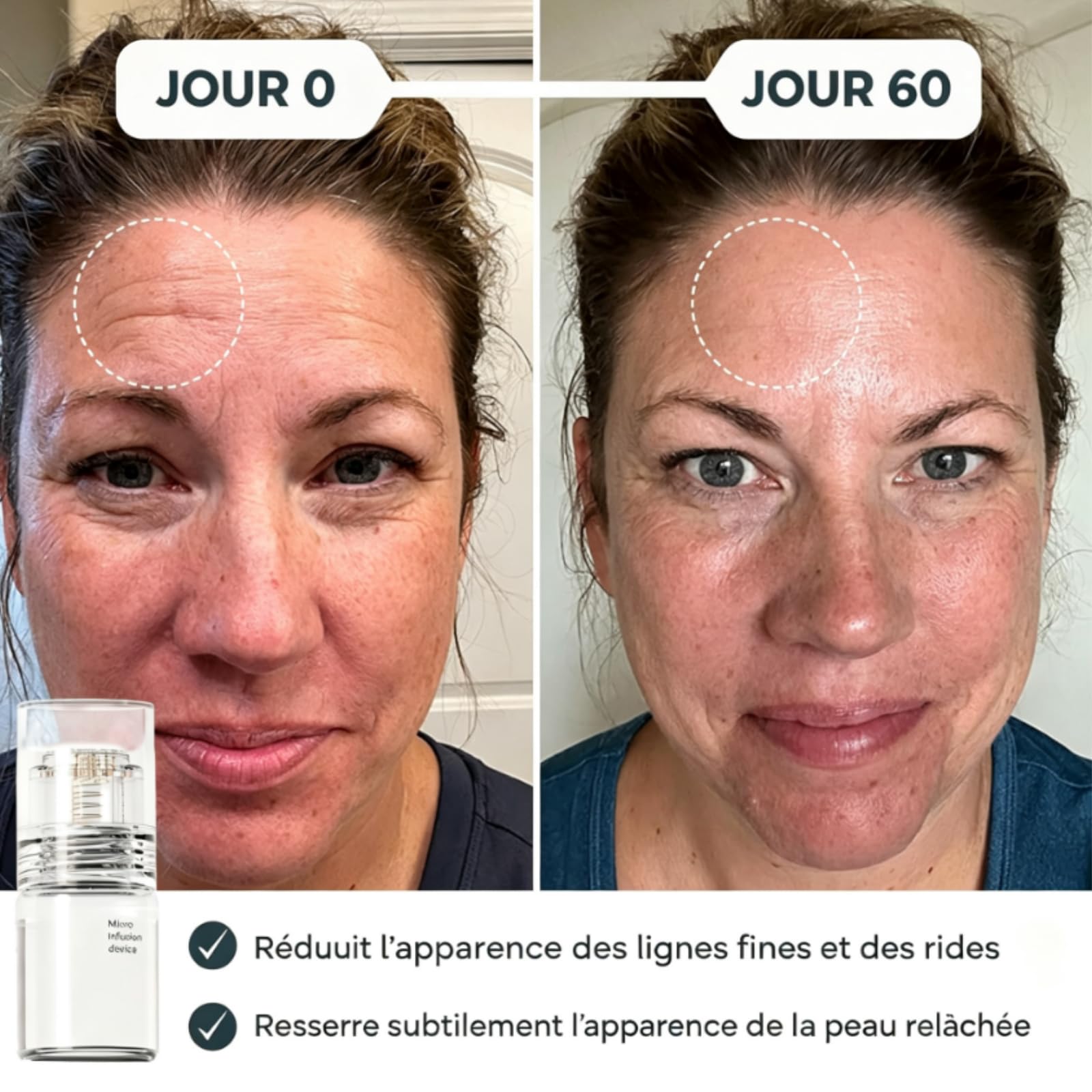 Ceralyne Sérum Micro Injection Visage,Micro Infusion Anti-Age
