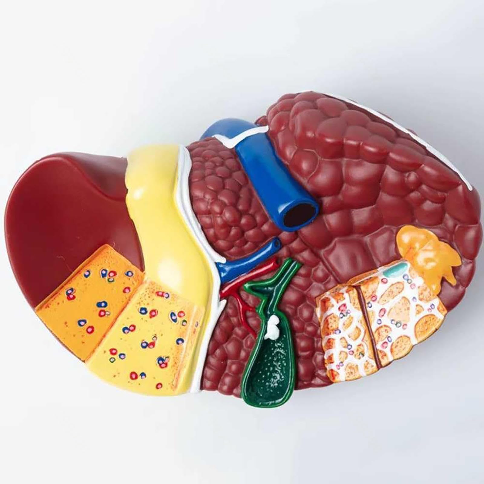 Naturalnej wielkości model anatomiczny wątroby człowieka z podstawą i wyraźną teksturą oraz cechami patologicznymi Model raka wątroby do prezentacji dydaktycznej Materiały do nauki