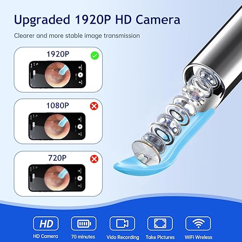 Miniatura 2 de Herramienta de eliminación de cera de oídos, limpiador de oídos con cámara HD 1920, kit de cámara visual inalámbrica con 6 luces LED, limpieza de