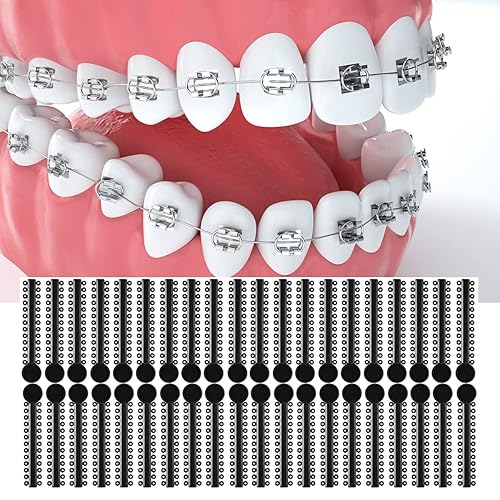 Miniatura 3 de Bandas de goma para aparatos ortopédicos, 1040 unidades de ligadura de ortodoncia negra, juntas tóricas, bandas elásticas
