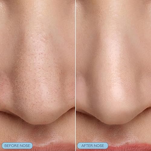 Miniatura 3 de Bioré - Mascarilla de nariz burbujeante para refinar poros, ácido glicólico y ácido hialurónico exfoliante para cara, mascarilla limpiadora de