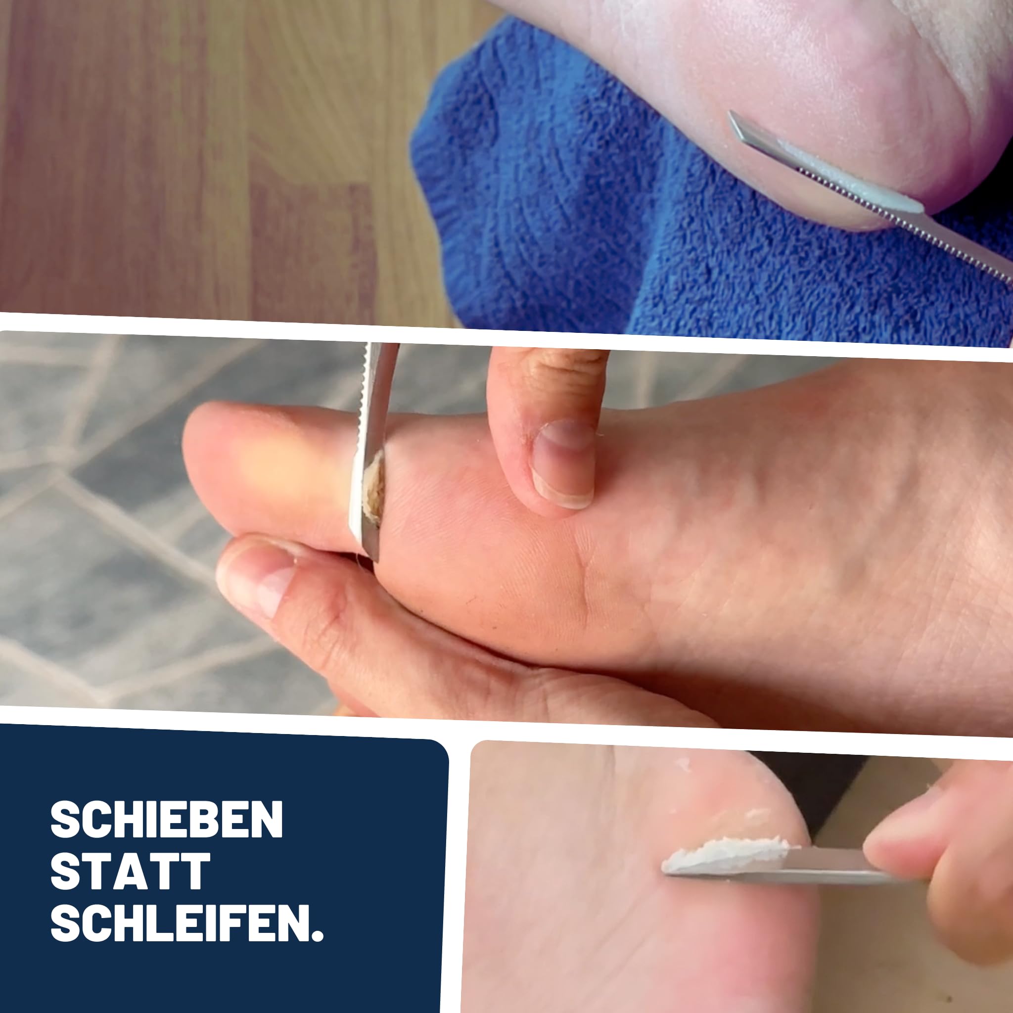 Mr. Fuss® Anti-Callus, Regrowth System - Środek do usuwania martwego naskórka - Rozwiązanie nr 1 - silnie zmiękcza