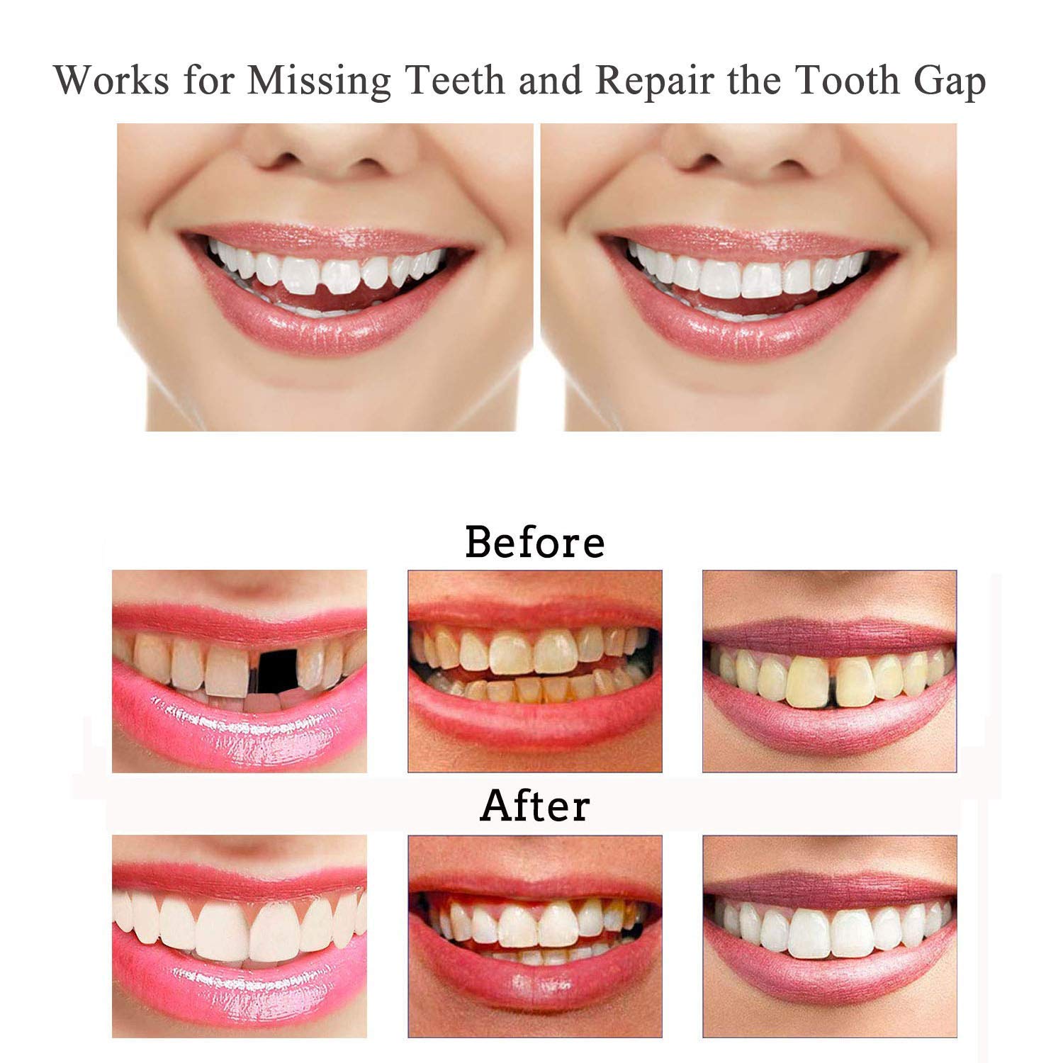 DBSUN 2in1 Teeth Veneers and Thermal Beads ReplacementKit.Used to