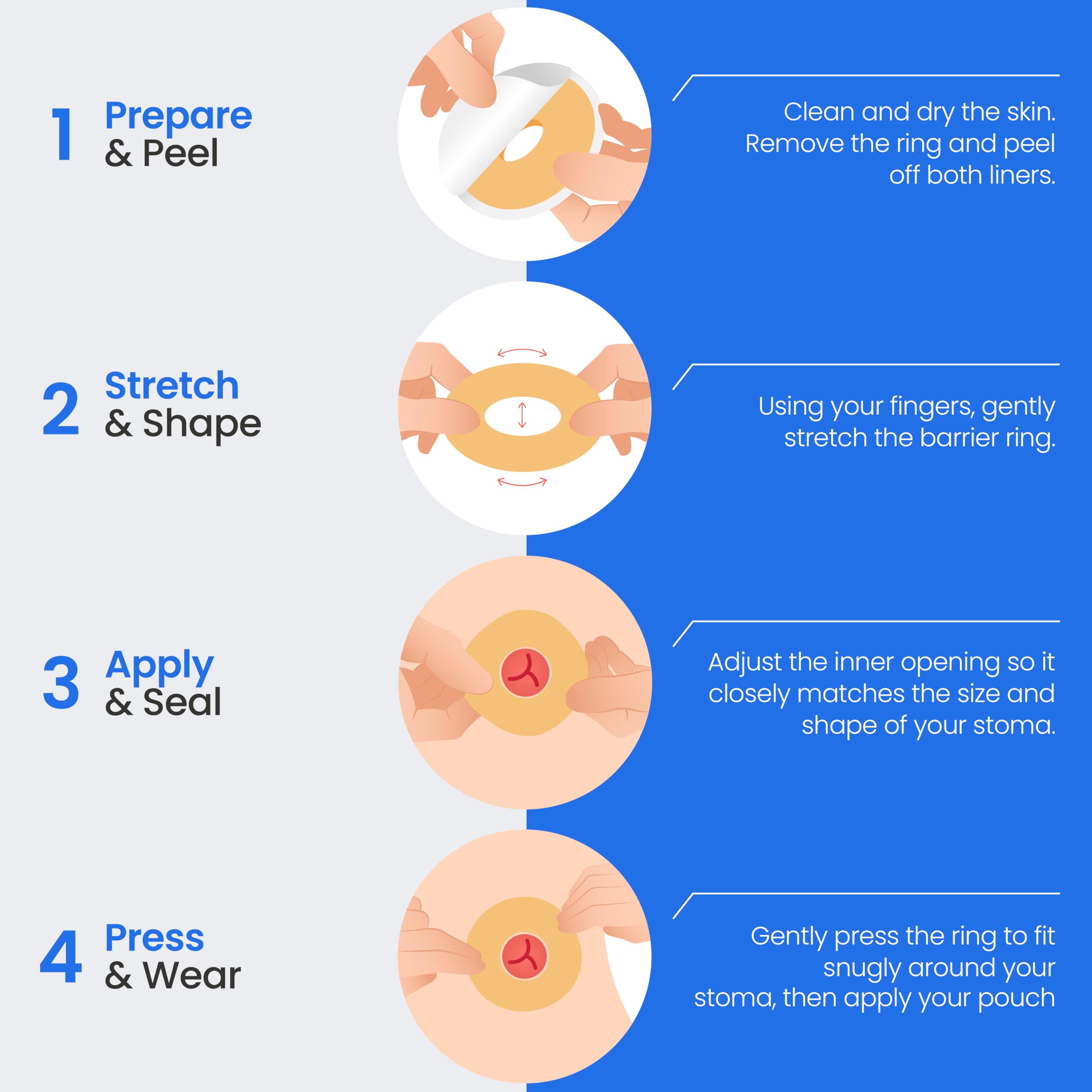 Safe n' Simple Conforming Adhesive Seals -2 Inch - Pack of 10 - Stoma Barrier Rings Barrier - Cohesive Skin Barrier - Accessories for Ostomy-Colostomy-Ileostomy- Supplies