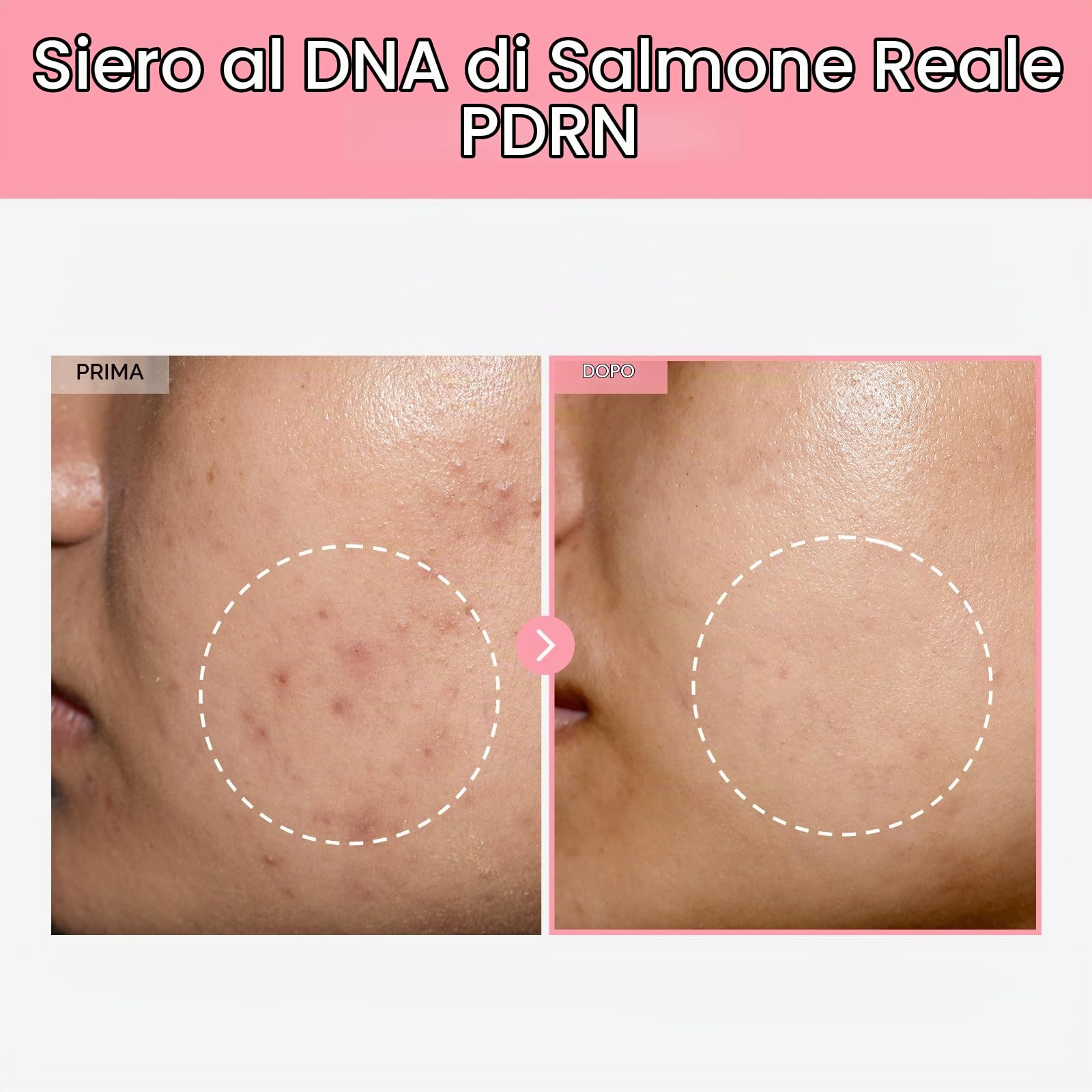 TOSOWOONG Duo Luminosità e Compattezza: Siero Pink Peptide 12 PDRN & Crema Gel PDRN Collagen per una Luminosità Giovanile