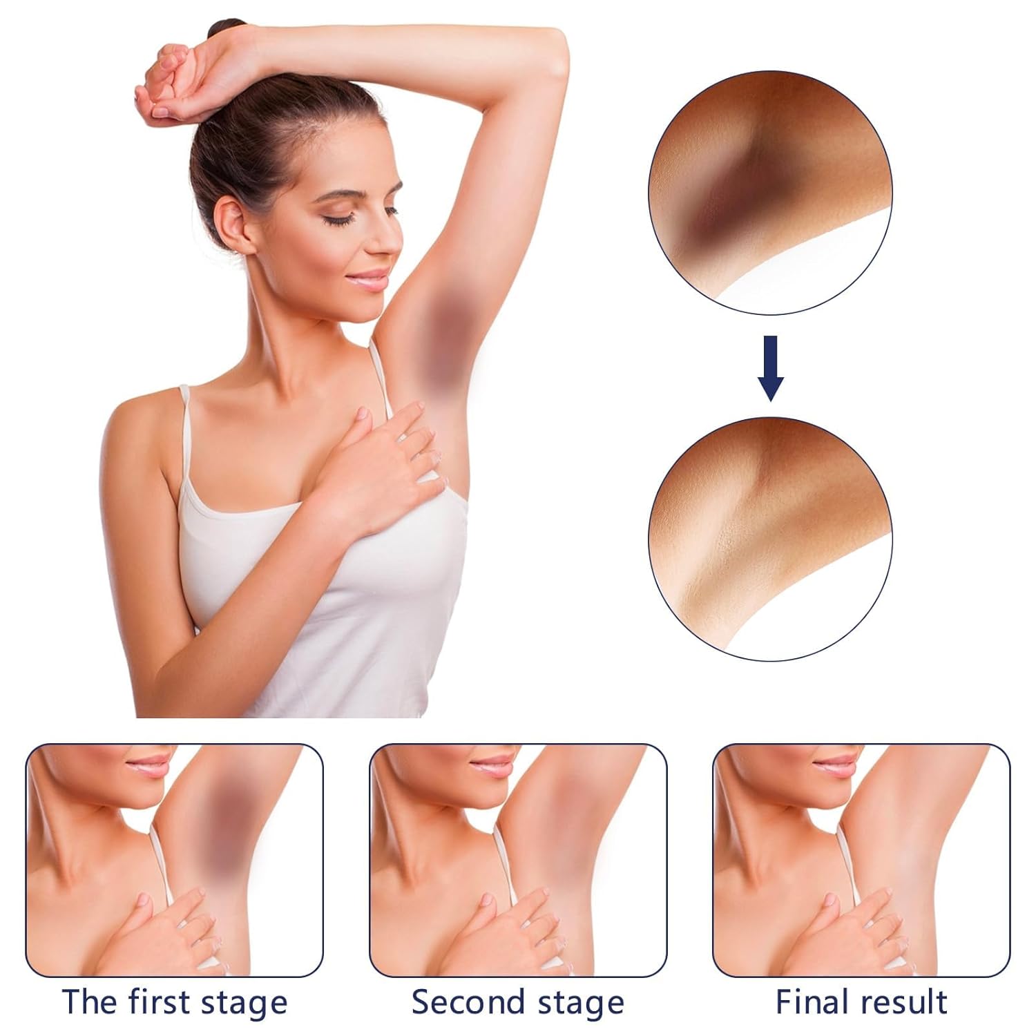 Intimate Areas Skin Lightening Bleaching Cream for Body Sensitive Intimate Area, Private Parts, Underarm, Knees, Elbows, Inner Thigh, Bikini Areas,Skin Whitening Cream Dark Spot Remover. - Image 5