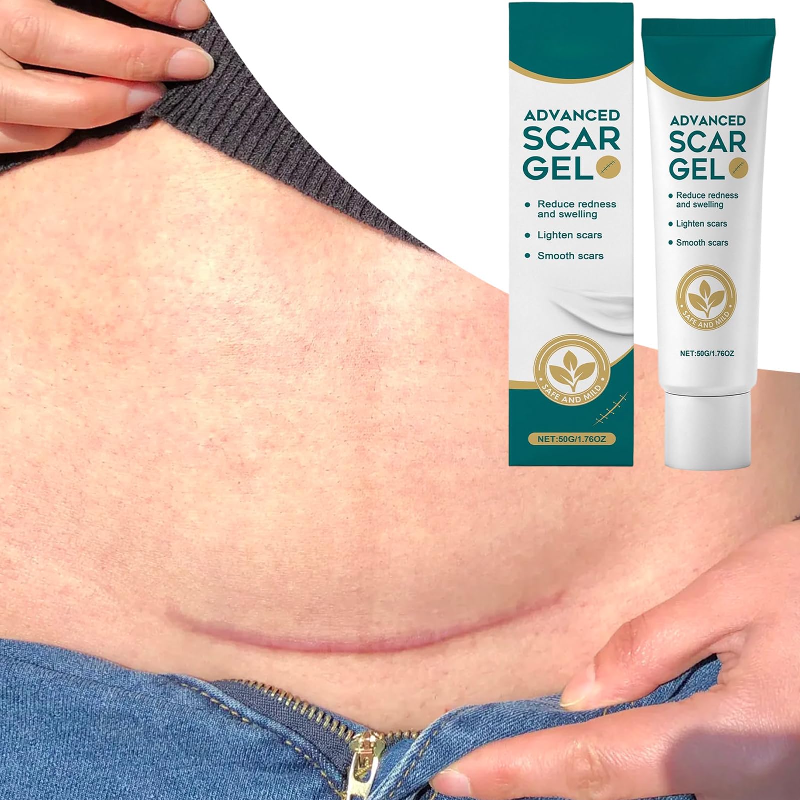 Gel de Silicona para Cicatrices - 50 Gramos Producto Para Desvanecer Marcas De Quemaduras,Nueva Crema Calmante Para Cicatrices,Para Hombres Y Mujeres, Queloides, Amantes De La Belleza, Viajeros, Rutin