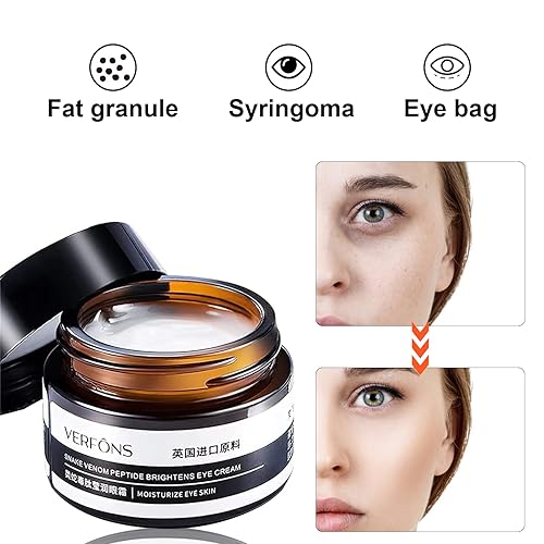 Miniatura 2 de Verfons - Crema reafirmante para ojos, crema de ojos reafirmante de veneno de serpiente, Verfons crema de ojos reafirmante temporal para bolsas,