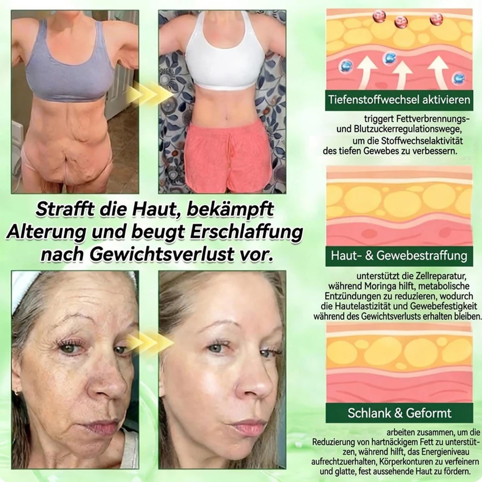 Luxarise Moringa 10-IN-1 Fortgeschritten Nano Mikronadel Pflaster, Natürliches Abnehmpflaster, Luxarise Moringa Pflaster, Sanfte Beruhigung, für Männer und Frauen (6 Stück)