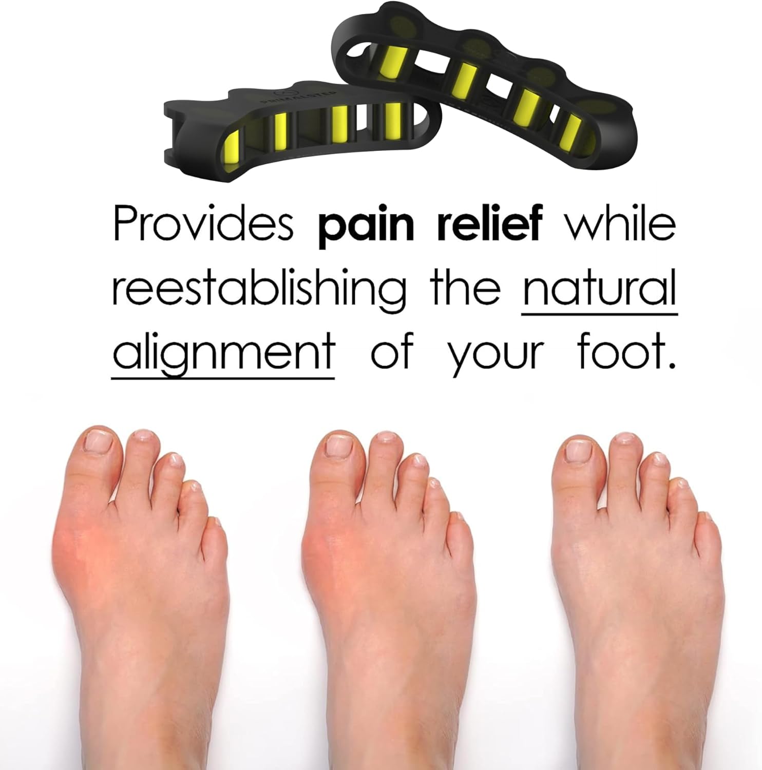 VYCE PrimalStep Fully Adjustable Toe Separators - Over 50% Thicker & More Durable - Doctor Recommended, Multiple Patents Pending - Stretches to Fit - 4 Pack Adjustable Bundle (1 Pair Size S/M & 1 Pair