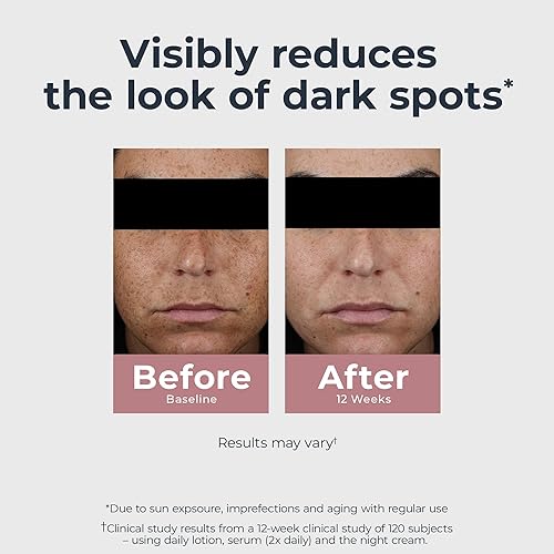 Miniatura 4 de Eucerin Radiant Tone - Suero dual corrector de manchas oscuras, suero de manchas oscuras con tiamidol y ácido hialurónico, ayuda a reducir