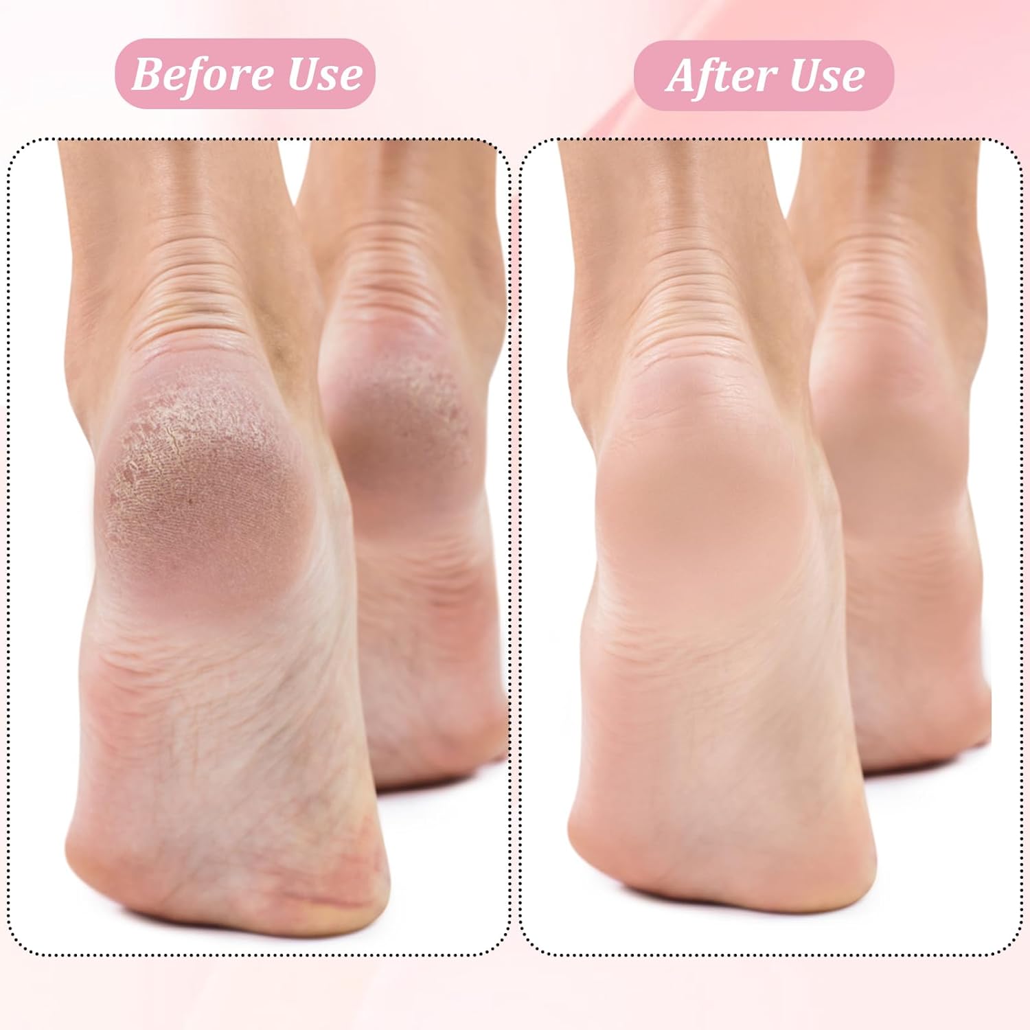 13 Pcs Replacement Roller Heads for Flawless Pedi, Suit for Finishing Touches Flawless Pedi Electric Foot File, 6 Pcs Black Coarse＆3 Pcs Gray Fine＆3 Pcs Pink Fine,1 Pc Cleaning Brush - Image 4