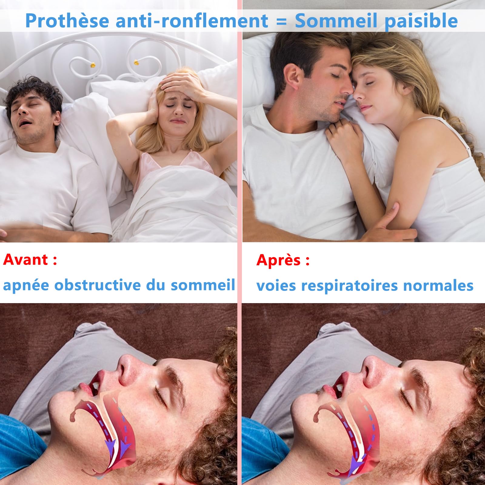 Orthèse DOHUG en Silicone : Stop Ronflements et Grincements - Dispositif Réglable, Puissant et Sécurisé pour la Santé Bucco-dentaire (Blanc, Moyen)
