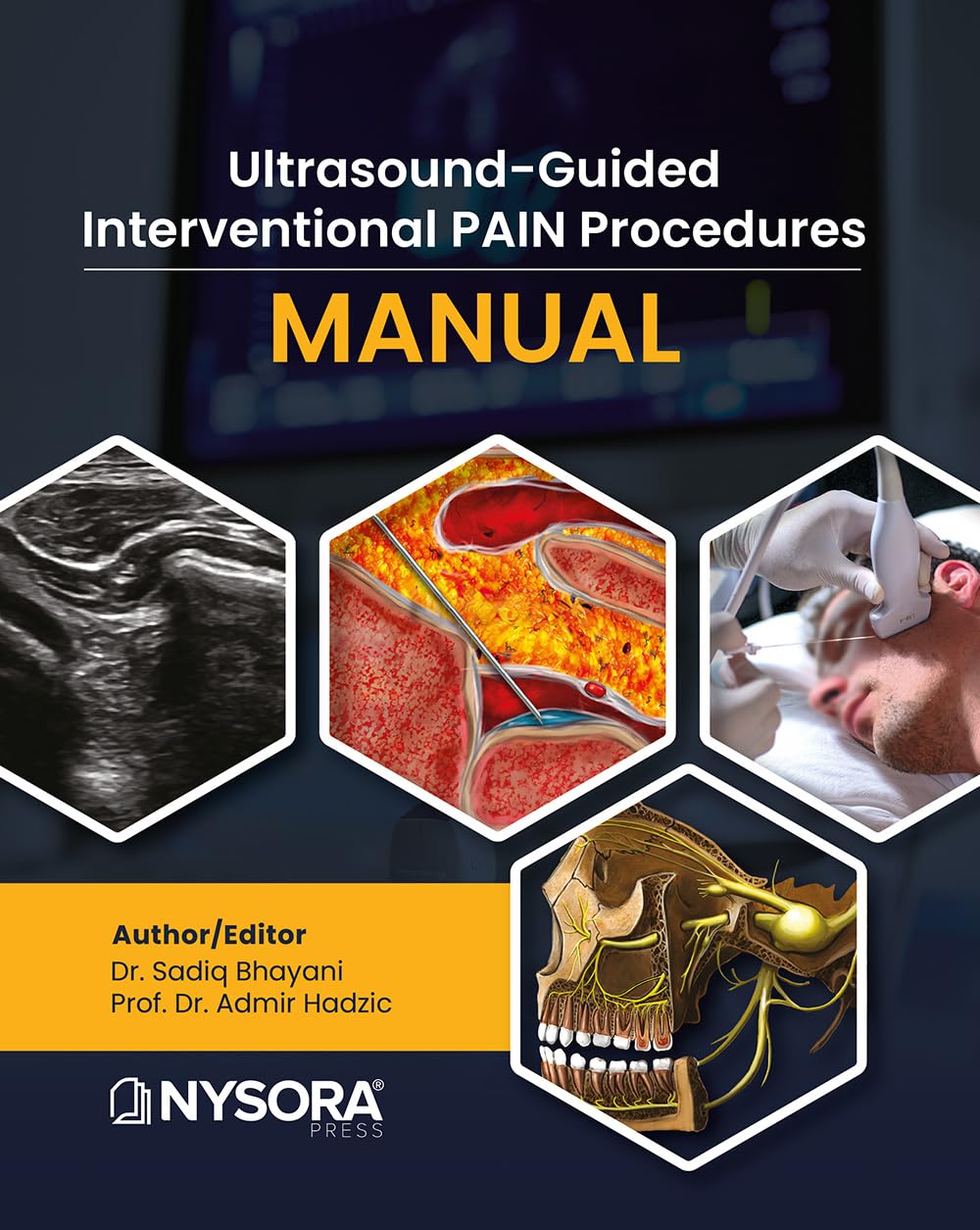 Ultrasound-Guided Interventional Pain Procedures Manual (English Edition)