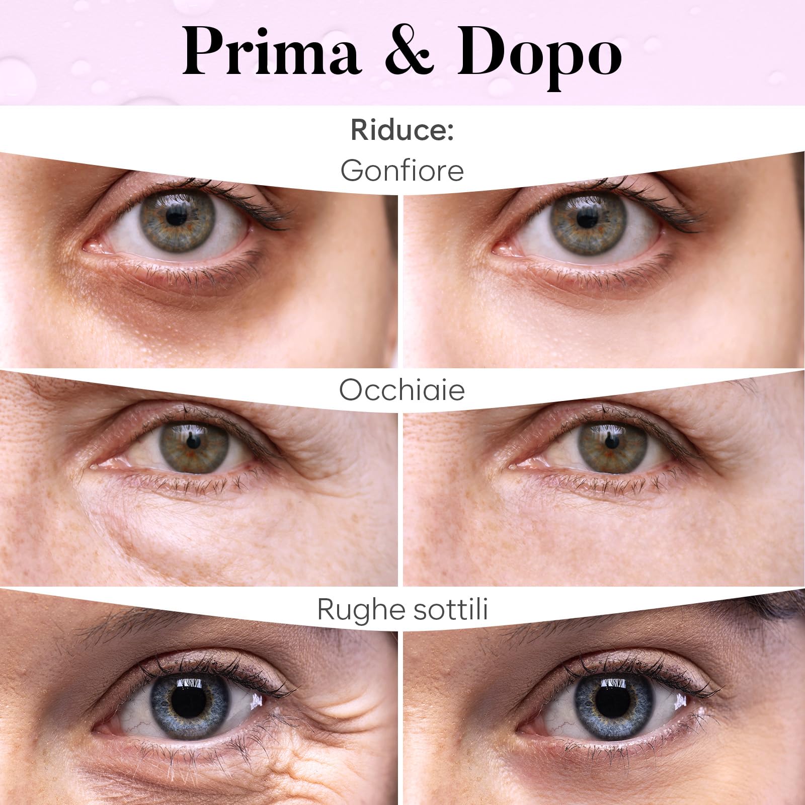 Patch Occhi, Maschera Occhi con PDRN, Caffeina e Collagene, Patch Occhiaie e Borse, Maschera Occhiaie, Eye Mask per Schiarente e l'idratazione (30 Paia)