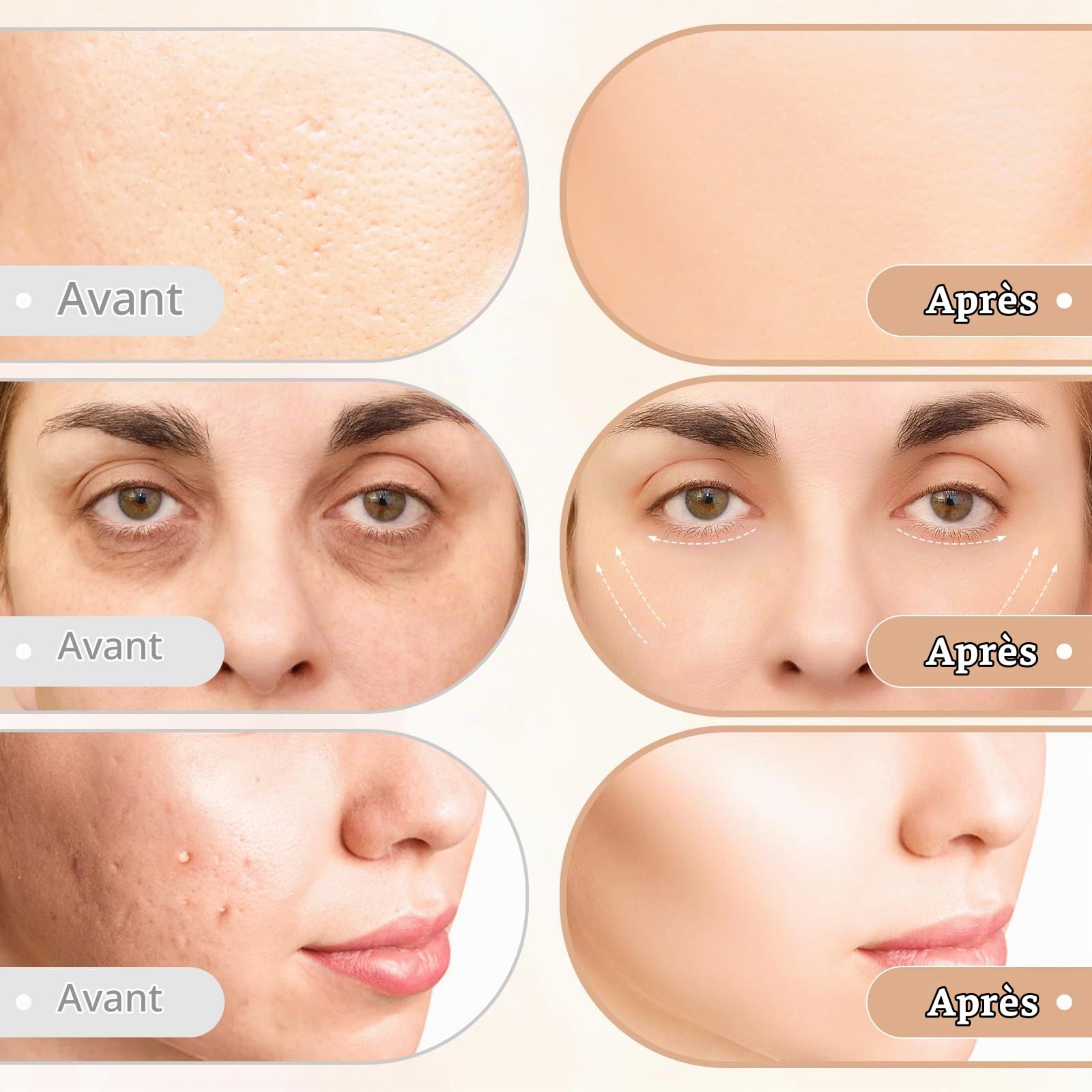 CARER BEAUTY Appareil Anti Rides Visage Appareil, 4 en 1 Dispositif de Beauté RF avec EMS Photothérapie Vibration Anti-rides et Anti-âge Soins du Visage pour les Femmes