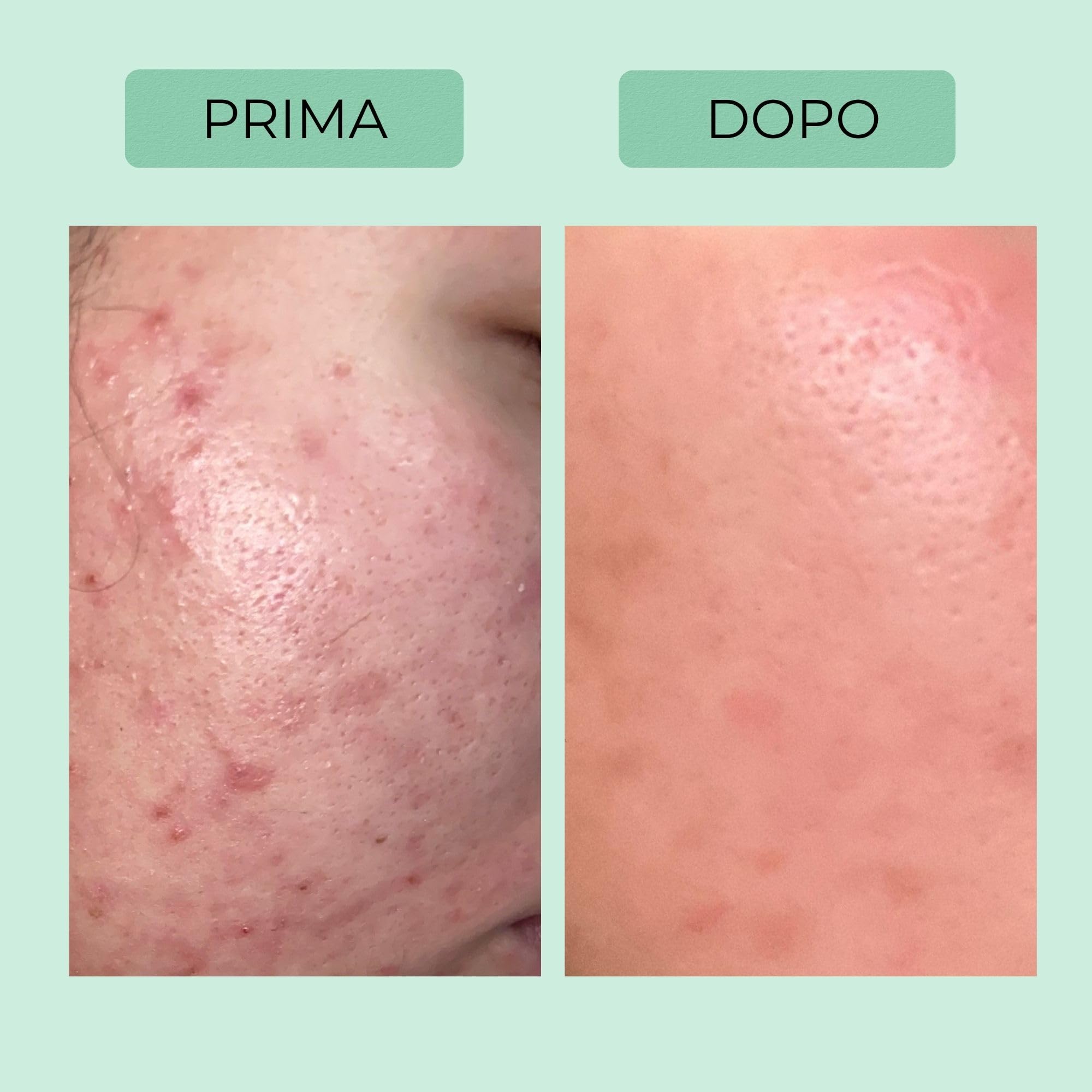 Afrodita Professional Niacinamide gel detergente per pelli grasse e miste, detergente delicato per il viso con acido ialuronico, pulizia profonda dei pori, 94% di origine naturale, senza alcool e