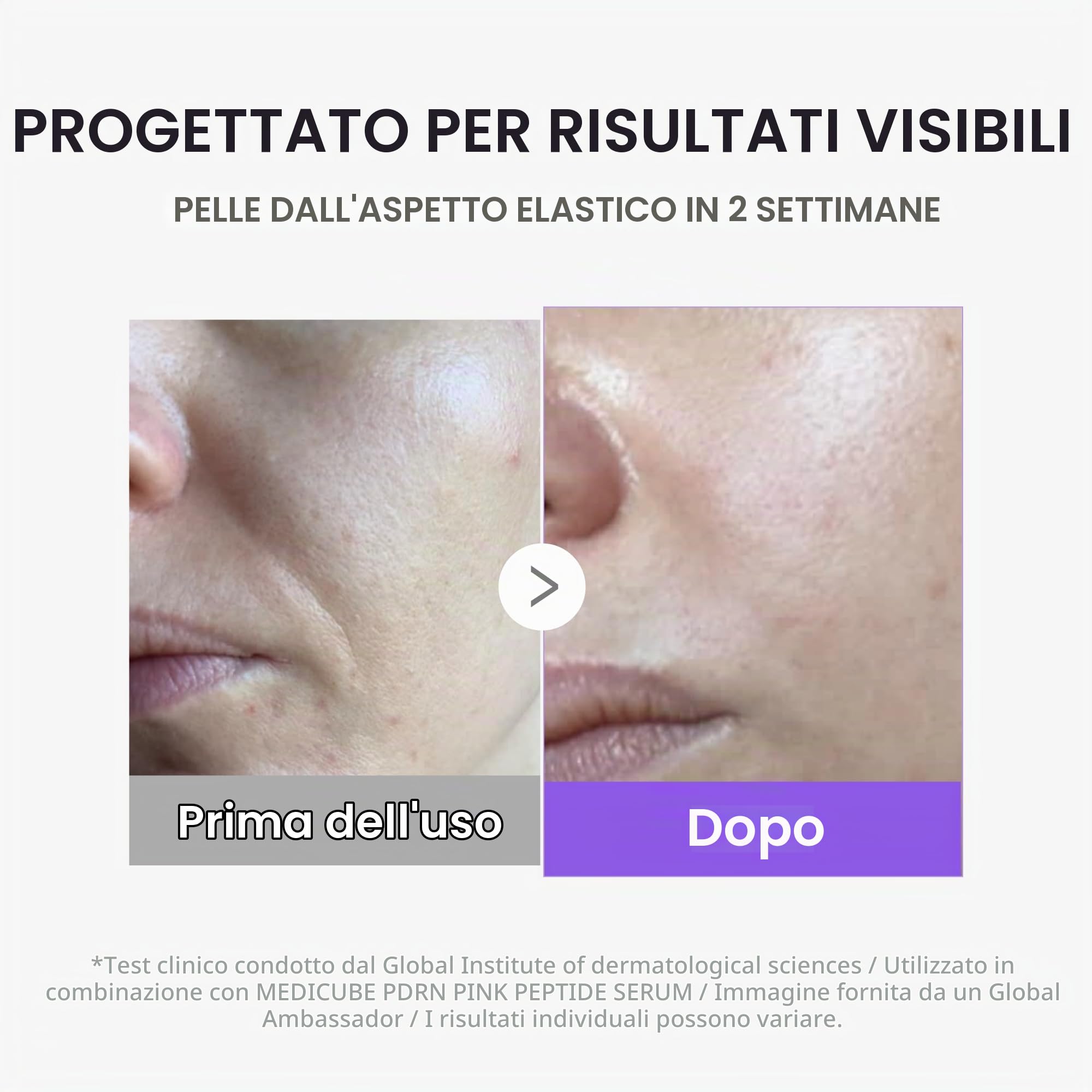 medicube Mini Booster Pro Plus | Dispositivo Viso per Luminosità, Effetto Lenitivo & Elasticità, 3 Modalità, Dispositivo Portatile per Skincare Coreana, Rosa