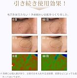 ANLAN ANLAN 5色LED美顔マスクの商品画像