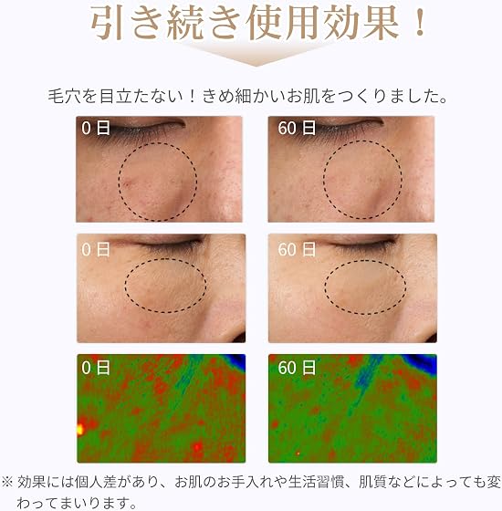 ANLAN ANLAN 5色LED美顔マスクの商品画像