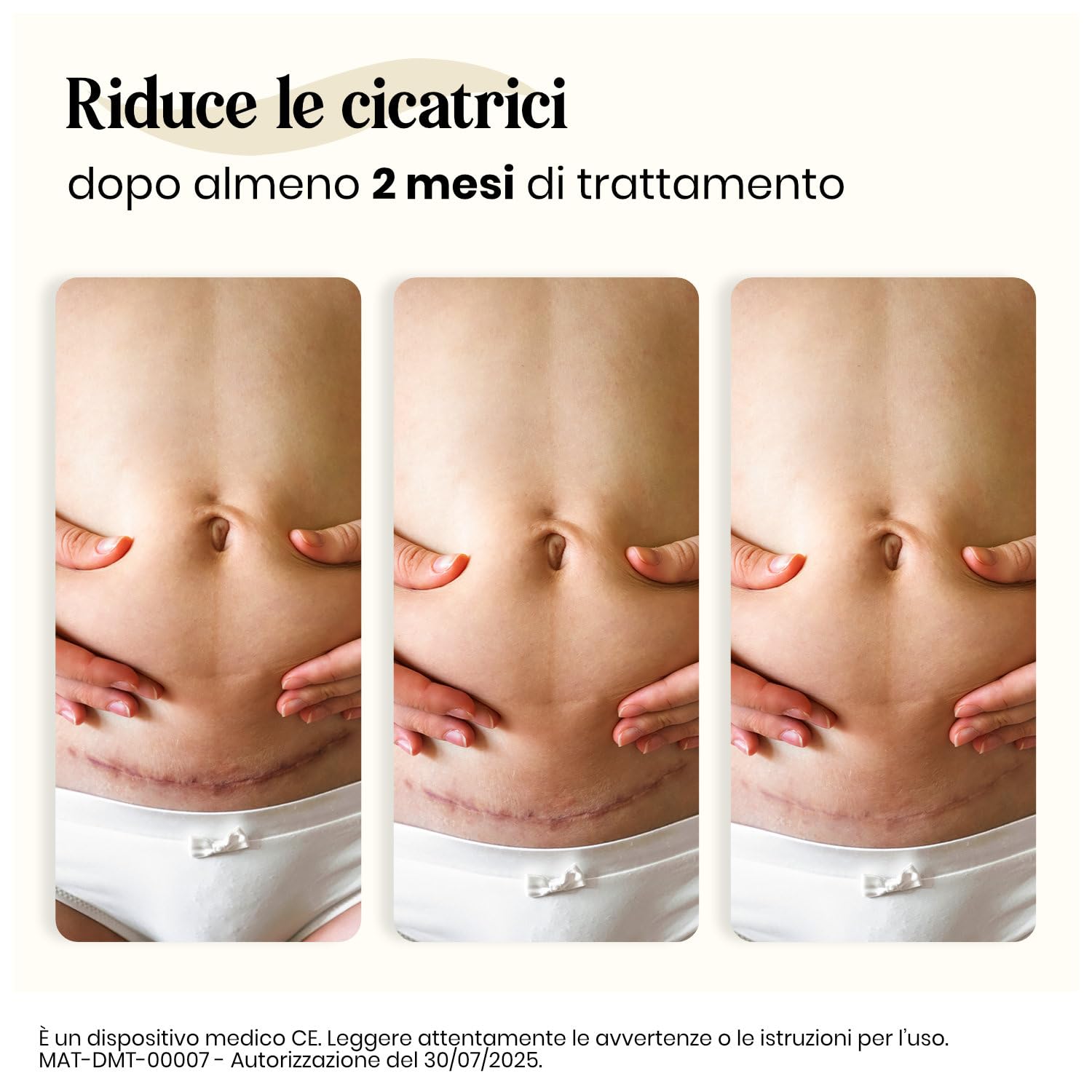Dermatix, Trattamento in Gel al Silicone per Cicatrici, Ustioni e Lesioni, Idrata e Allevia il Prurito, Rapida Asciugatura, Adatto a tutte le Zone del Corpo, 60g