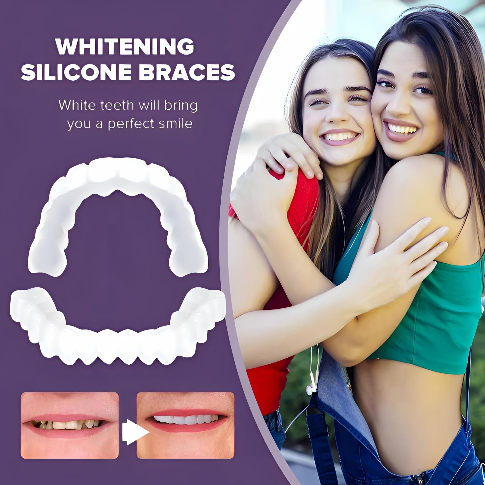 2 Pairs of Unisex Smile Supports,Natural Comfort, Adjustable Comfort (Unisex) Create A Beautiful and Confident Smile — view 7