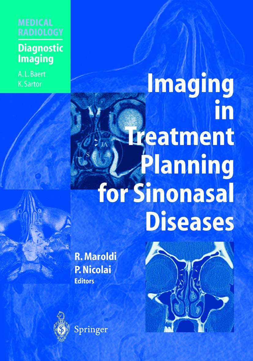 Ebook Imaging in Treatment Planning for Sinonasal Diseases 1 Edition