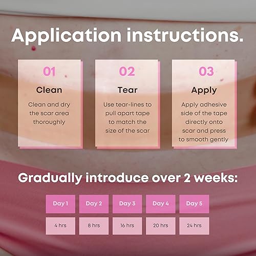 Miniatura 7 de Hojas de silicona para cicatrices, cinta de silicona de grado médico, personalizadas para mamás, extra largas de 1.6 x 120 pulgadas, perforaciones