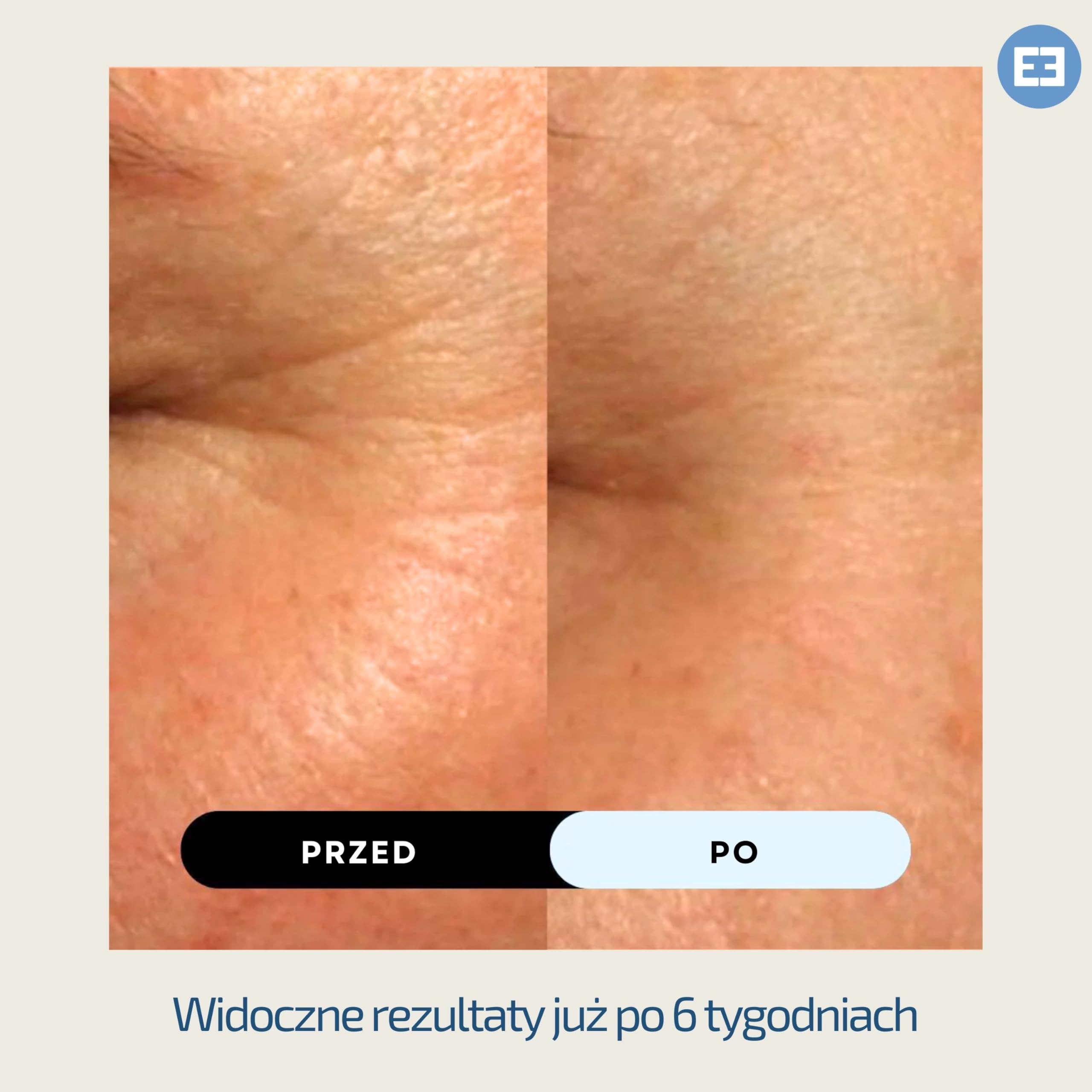 EiE 01 Serum do twarzy z peptydem Klotho – przeciwstarzeniowe i wygładzające z kwasem hialuronowym i retinolem – na zmarszczki i linie mimiczne – wegańskie, bezzapachowe, wyprodukowane w Szwecji 30 ml