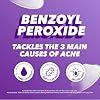 Acnecide Face Gel 5% Benzoyl Peroxide Acne Treatment for Spot Prone Skin 15g