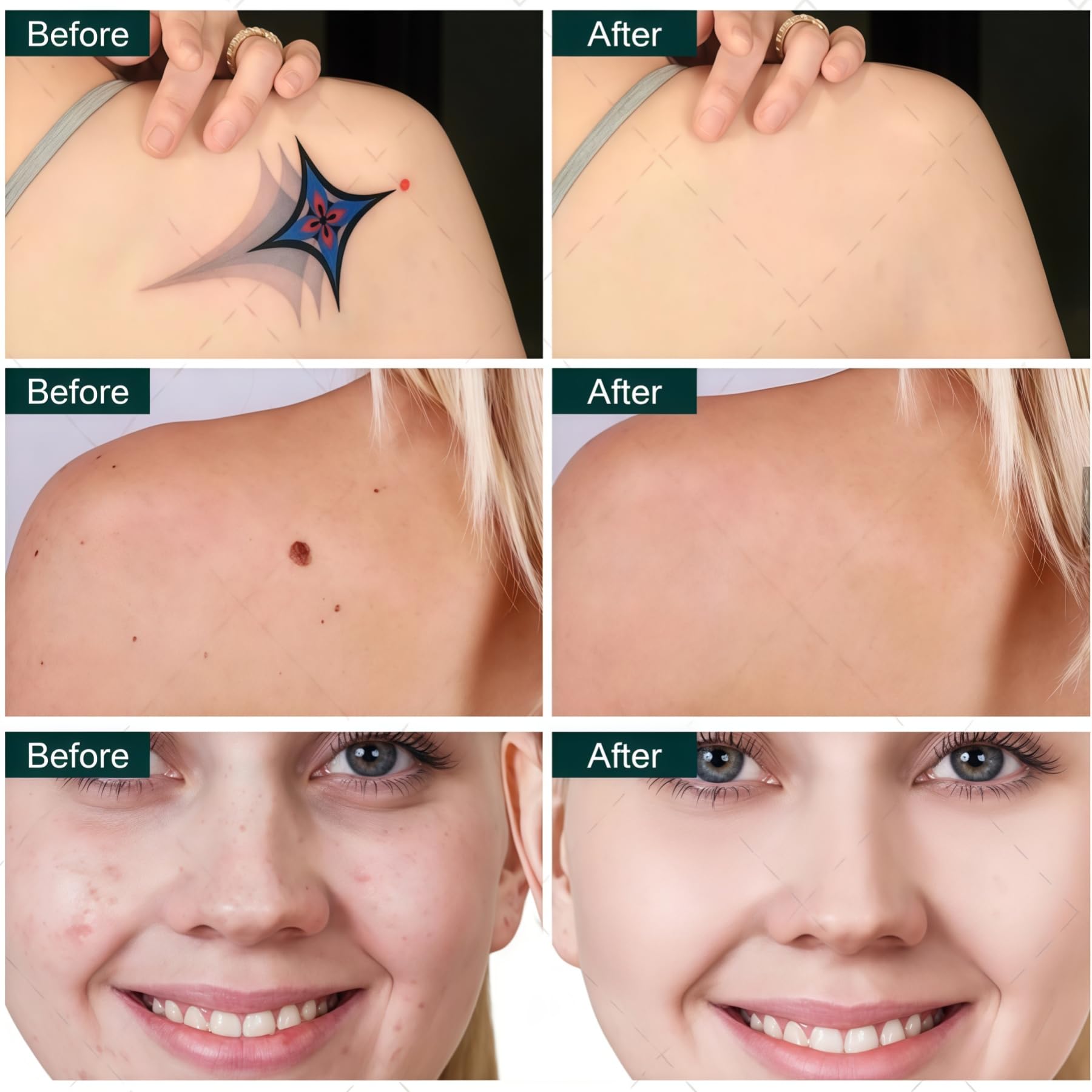 Nuova macchina laser a diodo 808 nm + laser pico 2-in-1 (2026), per epilazione professionale e rimozione tatuaggi