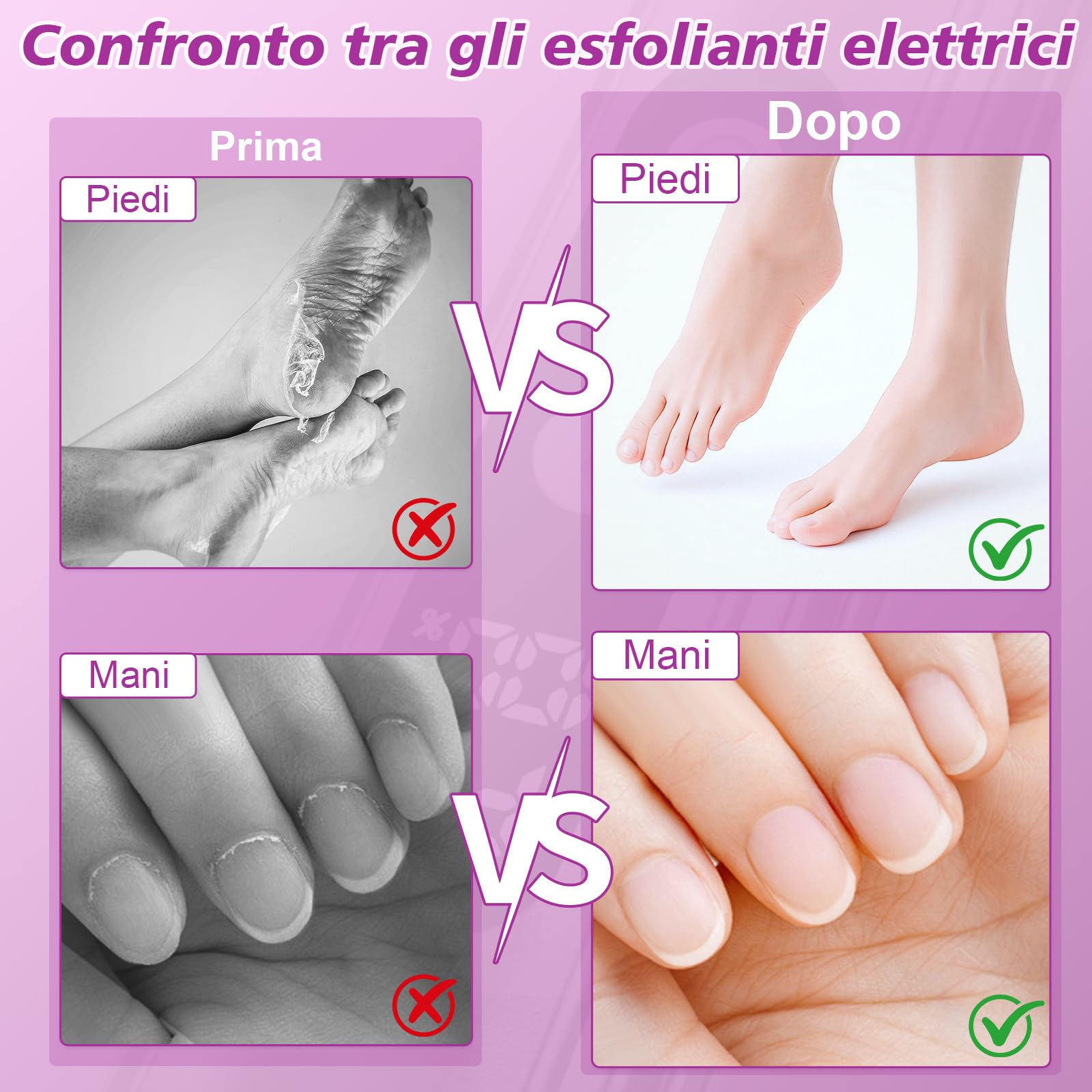 2 in 1 Pedicure Elettrico Professionale Pied,9 Velocità Rimuovi Calli Piedi Elettrica con Display LCD, Dischetti Sostituibili, Lima per Piedi Talloni Cura Piedi e Unghie,Rosa